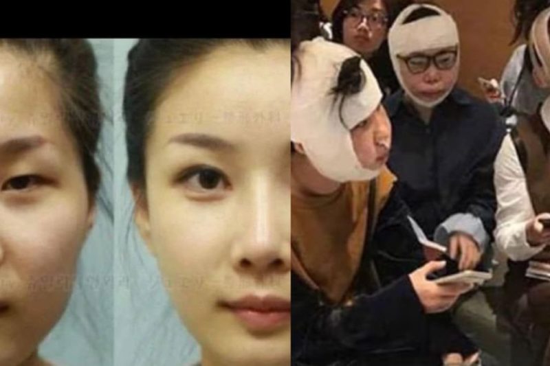 Why Chinese Women Get Plastic Surgery in South Korea