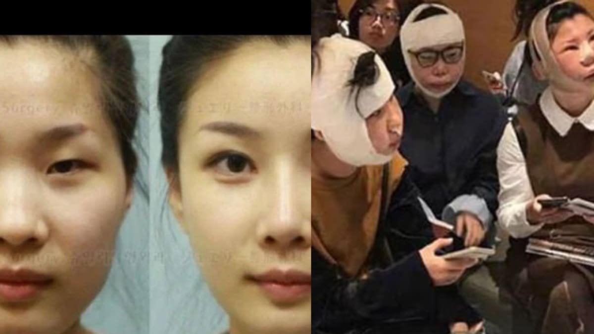 Why Chinese Women Get Plastic Surgery in South Korea